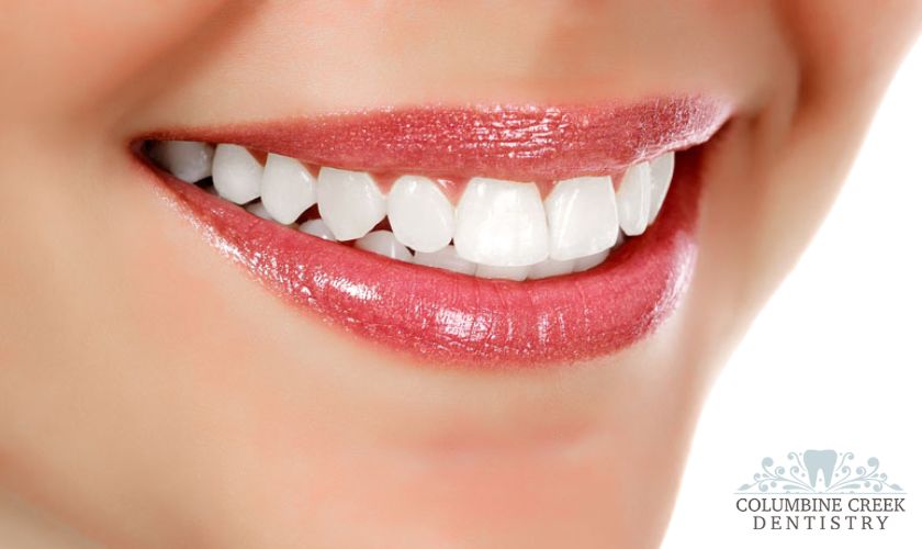 Cosmetic Dentistry Treatments in Littleton