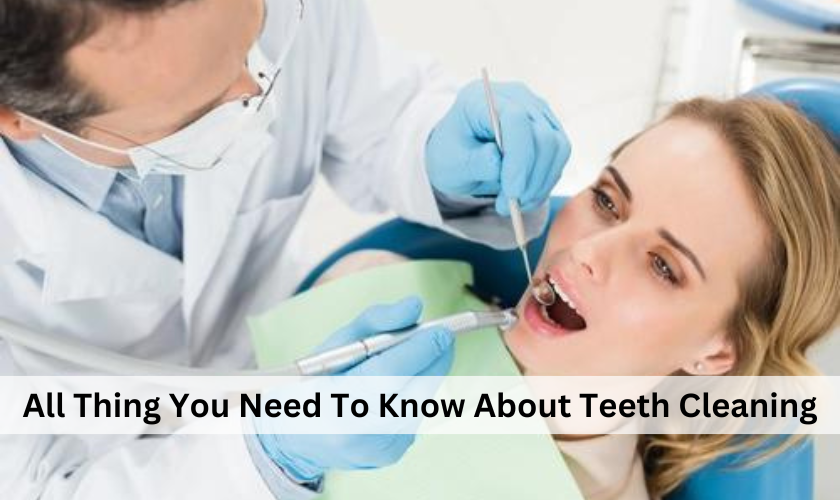 All Thing You Need To Know About Teeth Cleaning
