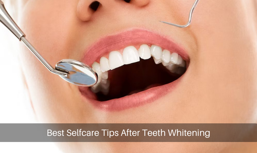 Best Selfcare Tips After Teeth Whitening