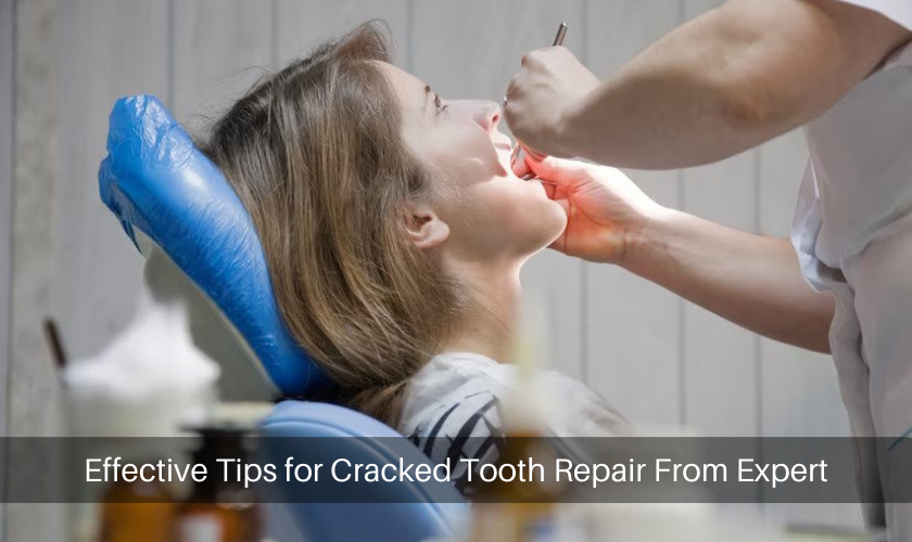 Effective Tips for Cracked Tooth Repair From Expert