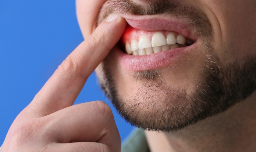 Gum Disease Treatment in Littleton CO